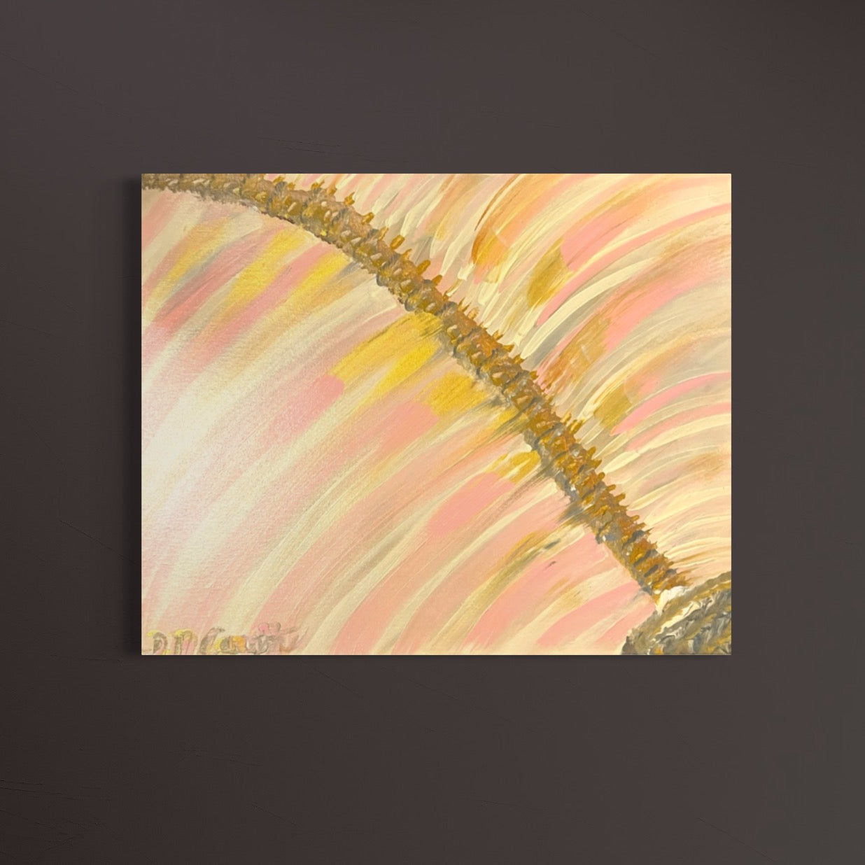 Disjointed Spinal Dysraphism Life With Invisible Disabilities Original Abstract Acrylic Canvas by Deanna Caroon